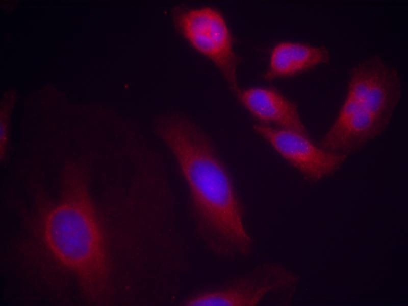 Anti-Phospho-NF-kB p65 (Ser536) Polyclonal Antibody 2