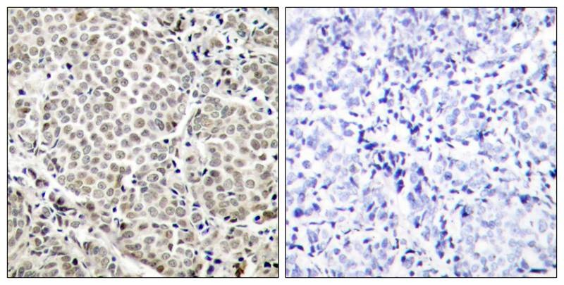 Anti-Phospho-NF-kB p65 (Ser529) Polyclonal Antibody