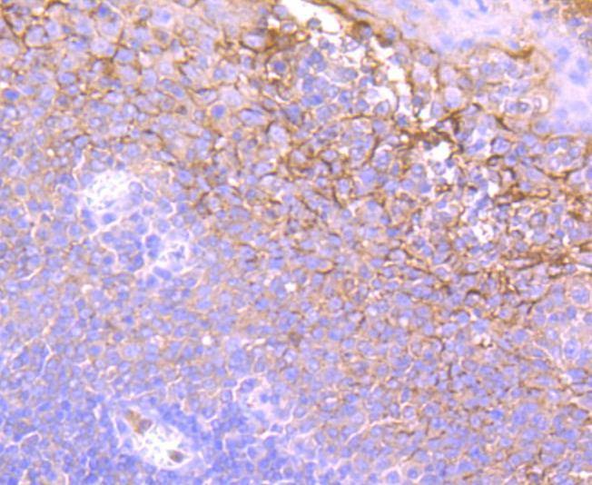 Anti-ELANE Antibody (2I484)