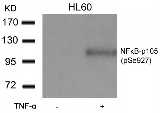 Anti-Phospho-NFKB1 (Ser927) Polyclonal Antibody