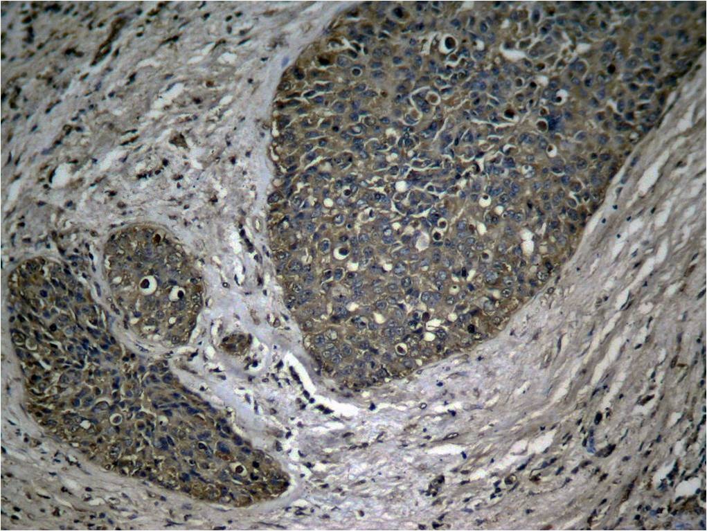 Anti-Phospho-NF-kB p65 (Ser536) Polyclonal Antibody 2