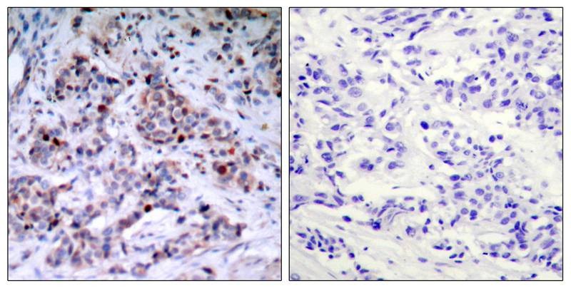 Anti-Phospho-NF-kB p65 (Thr435) Polyclonal Antibody 2