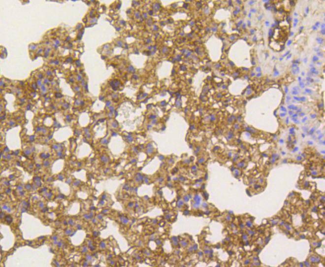 Anti-NF-kB p65 Antibody (4U638)