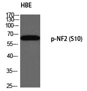 Anti-Phospho-Merlin (Ser10) Polyclonal Antibody