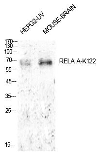 Anti-Acetyl-NF-kB p65 (Lys122) Polyclonal Antibody