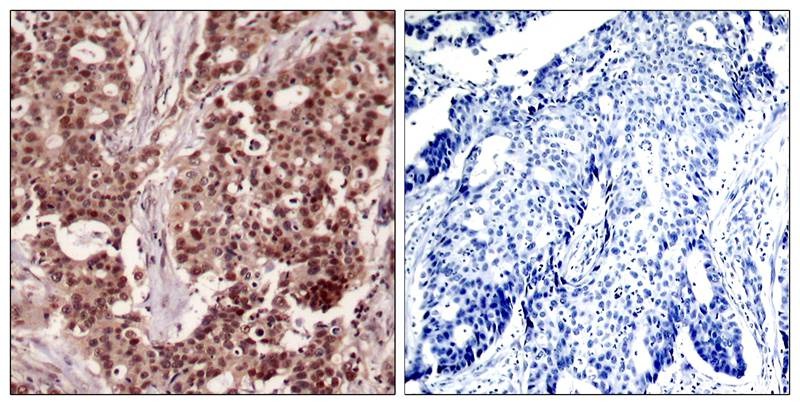 Anti-Phospho-NFKB1 (Ser927) Polyclonal Antibody