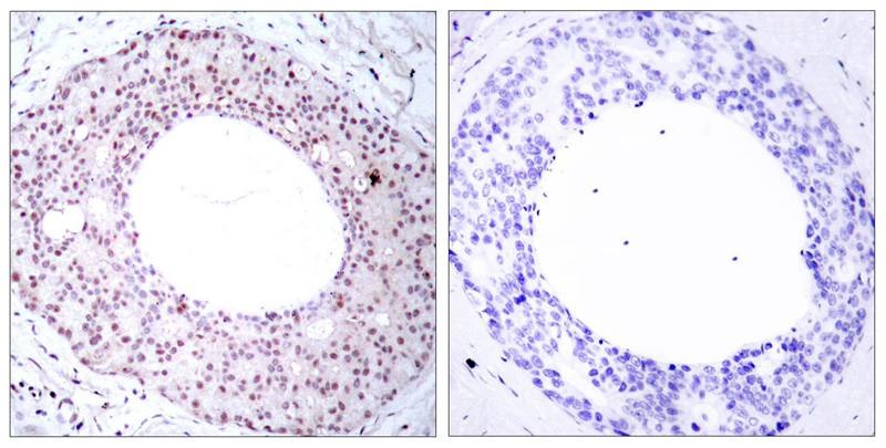 Anti-Phospho-NF-kB p65 (Thr254) Polyclonal Antibody 2