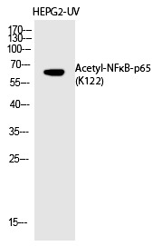 Anti-Acetyl-NF-kB p65 (Lys122) Polyclonal Antibody