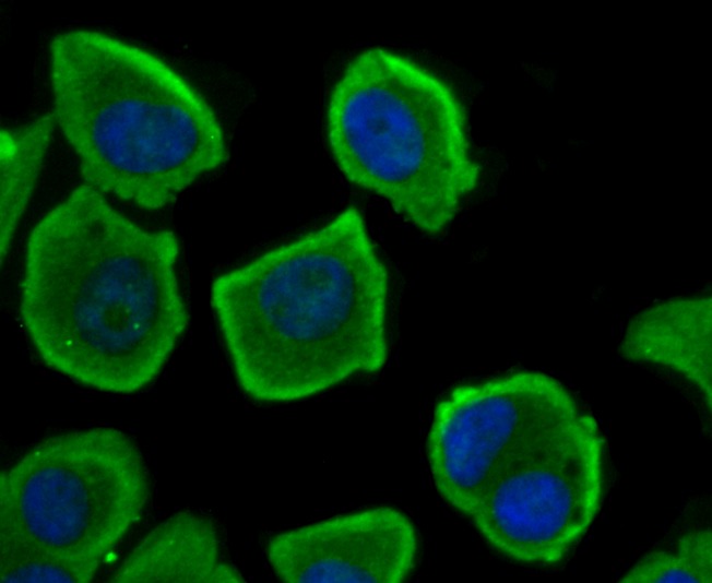 Anti-NFAT2 Antibody (1J539)