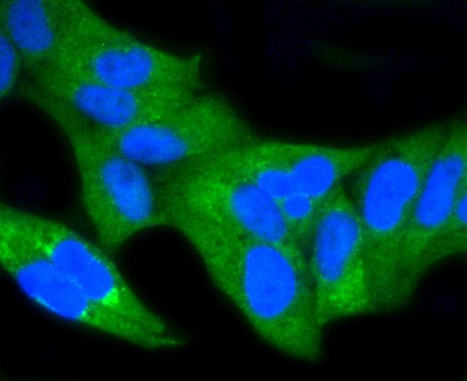 Anti-NF-kB p65 Antibody (4U638)
