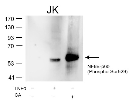 Anti-Phospho-NF-kB p65 (Ser529) Polyclonal Antibody
