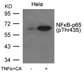 Anti-Phospho-NF-kB p65 (Thr435) Polyclonal Antibody 2