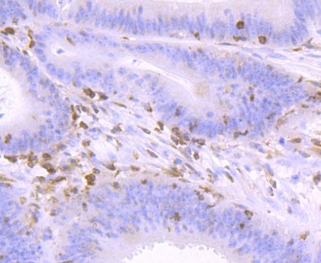 Anti-NFAT1 Antibody (4I426)