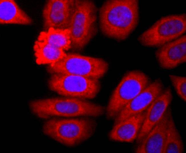 Anti-ELANE Antibody (2I484)
