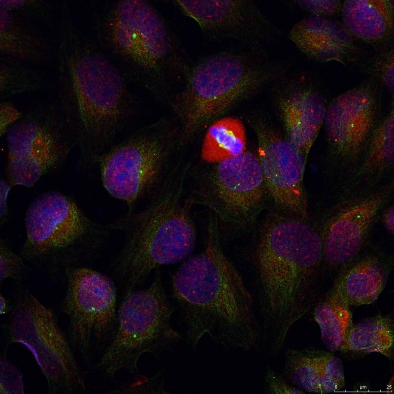Anti-Phospho-NFKB1 (Ser337) Polyclonal Antibody 2