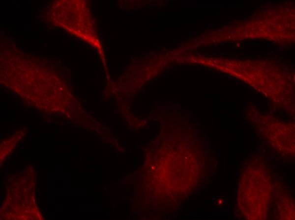 Anti-Phospho-NF-kB p65 (Ser529) Polyclonal Antibody