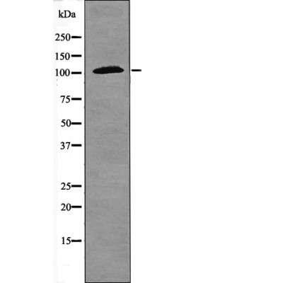 Anti-Phospho-NFKB1 (Ser923) Polyclonal Antibody
