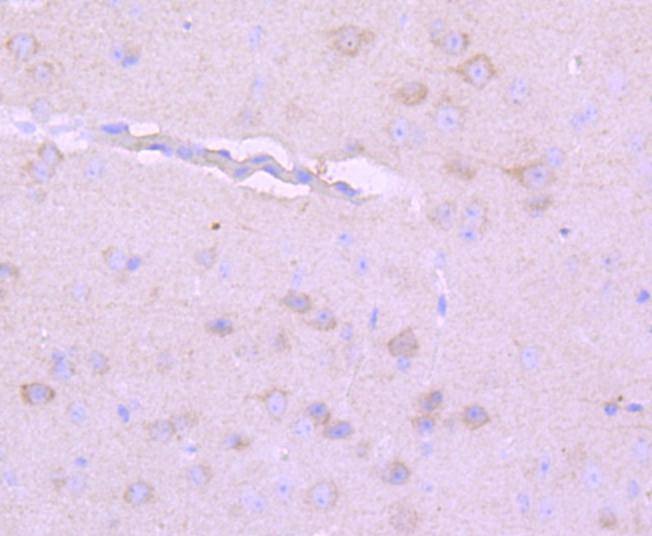 Anti-NEFH Antibody (9O45)