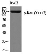 Anti-Phospho-HER2/ERBB2 (Tyr1112) Polyclonal Antibody