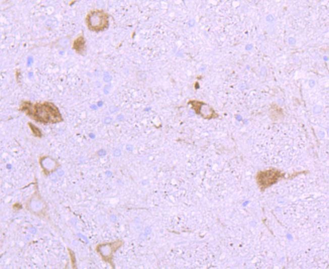 Anti-NEFH Antibody (9O45)