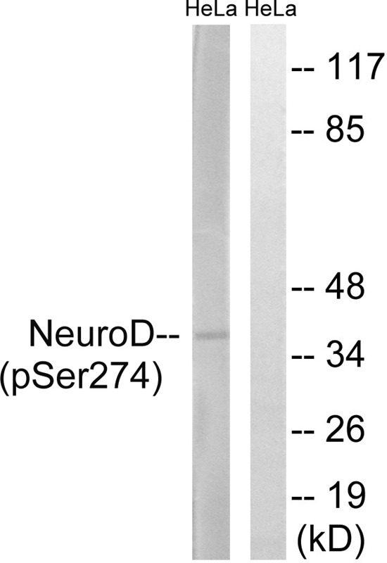 Anti-Phospho-NeuroD1 (Ser274) Polyclonal Antibody