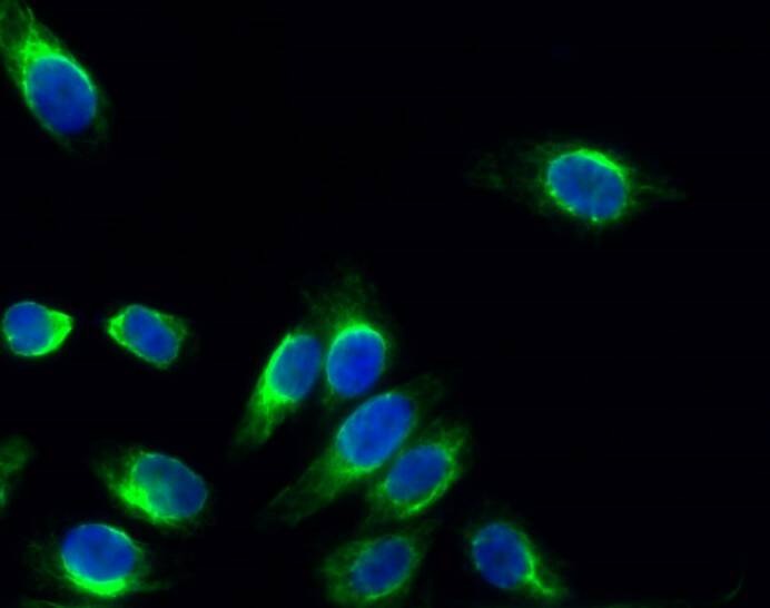 Anti-Phospho-MAPK14 (Thr180, 182) Polyclonal Antibody