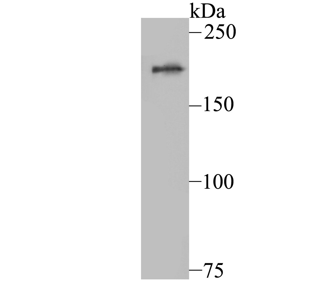 Anti-KDM5A Antibody (8P685)