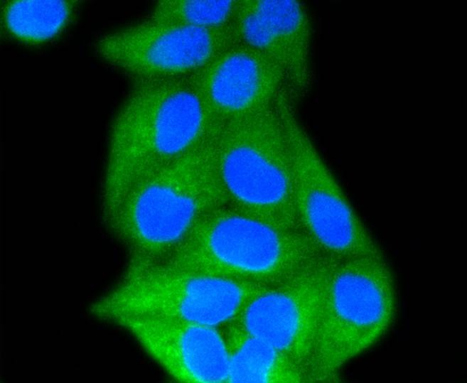 Anti-LDLR Antibody (1J54)