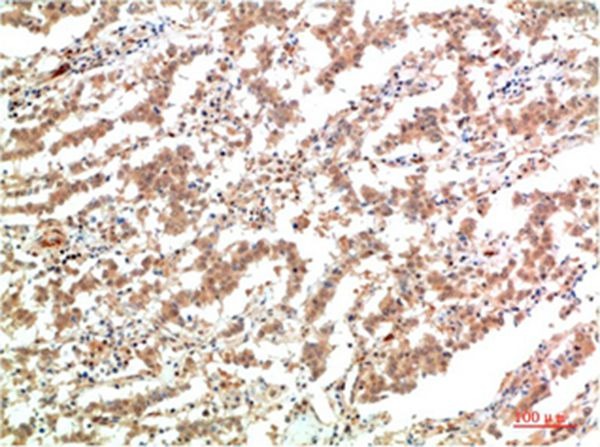 Anti-JAK2 Antibody (8S857)