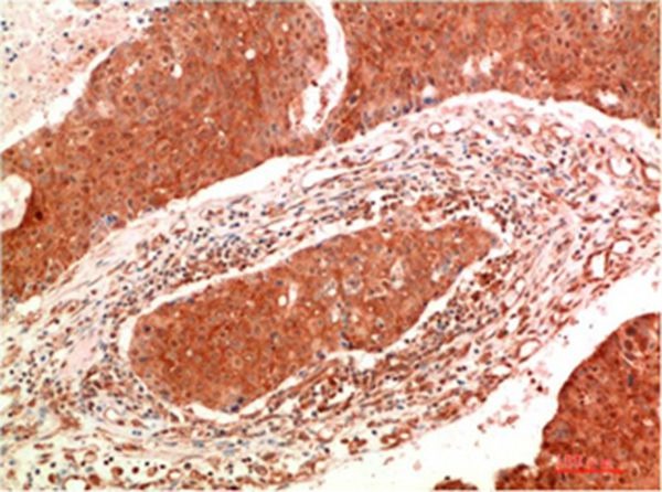 Anti-JAK2 Antibody (4H967)