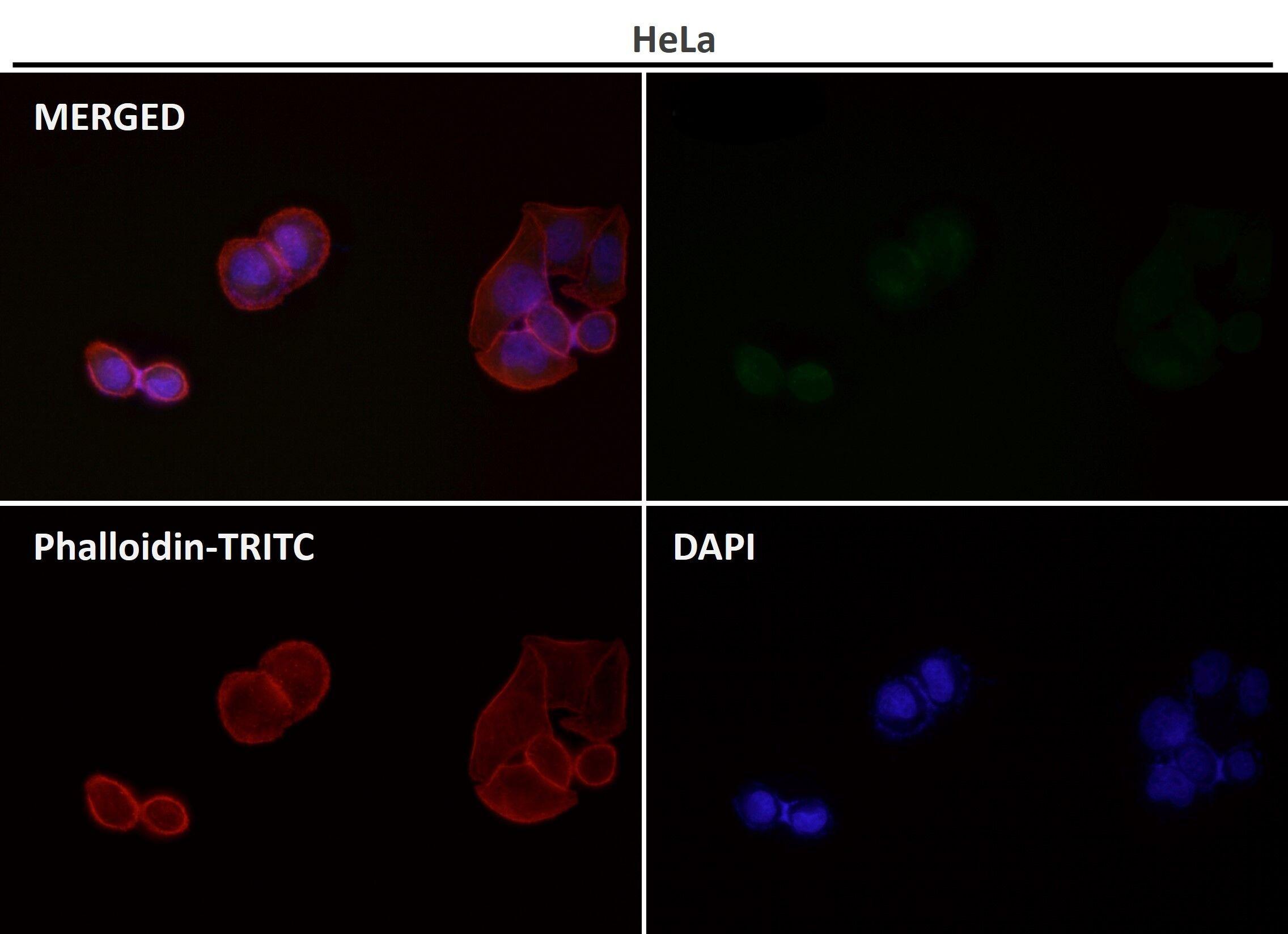 Anti-MAP1LC3B Antibody (7N270)