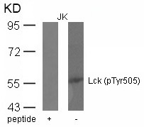 Anti-Phospho-Lck (Tyr505) Polyclonal Antibody