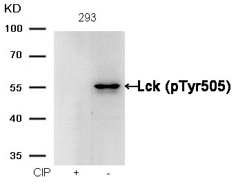 Anti-Phospho-Lck (Tyr505) Polyclonal Antibody
