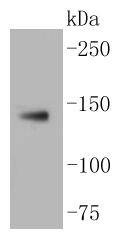 Anti-LDLR Antibody (1J54)
