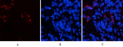 Anti-LTF/Lactoferrin Antibody (6J204)
