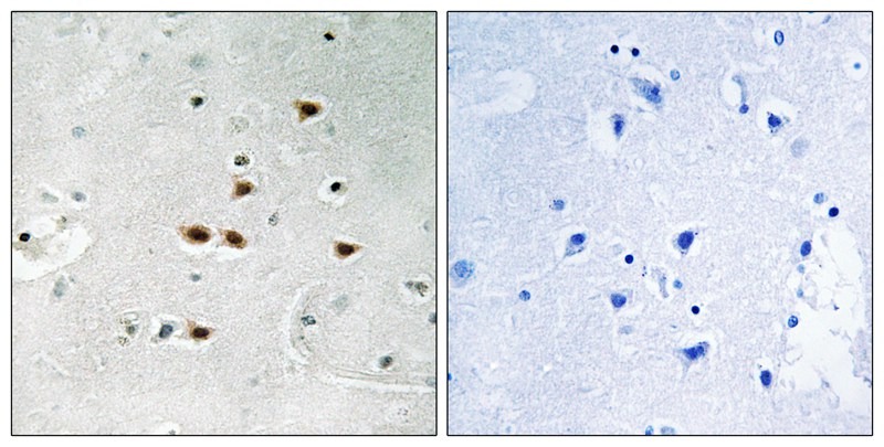 Anti-Phospho-ITCH (Tyr420) Polyclonal Antibody