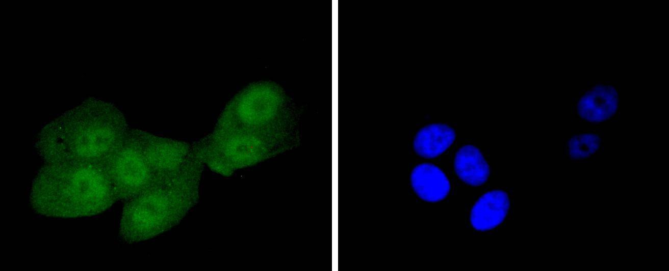 Anti-IRS-1 Antibody (6O938)
