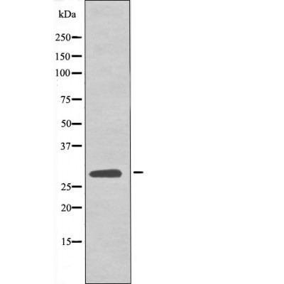 Anti-Phospho-LAT (Tyr161) Polyclonal Antibody