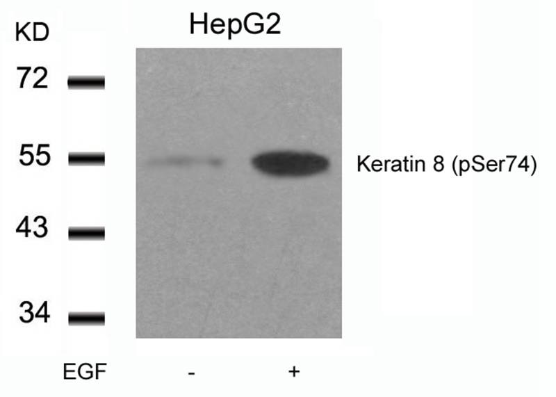 Anti-Phospho-KRT8 (Ser74) Polyclonal Antibody