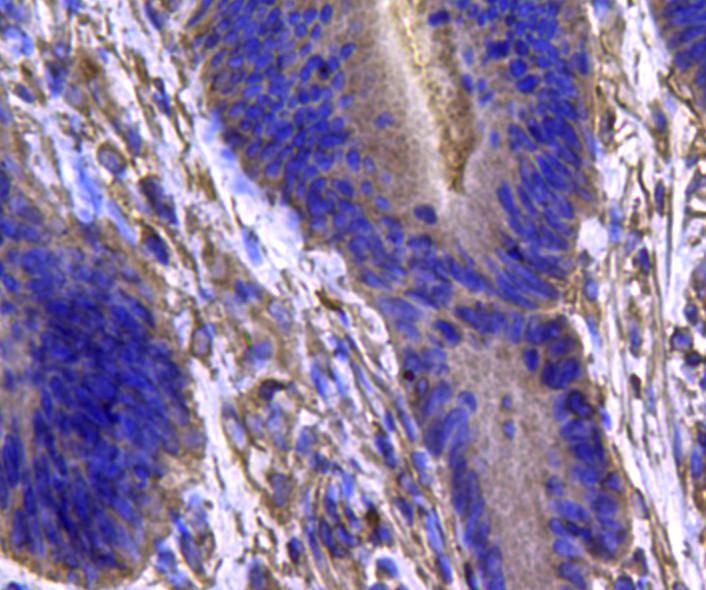 Anti-Isocitrate dehydrogenase/IDH1 Antibody (9Q57)