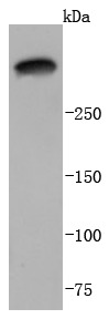 Anti-Laminnin 5 alpha 3 Antibody (7L607)