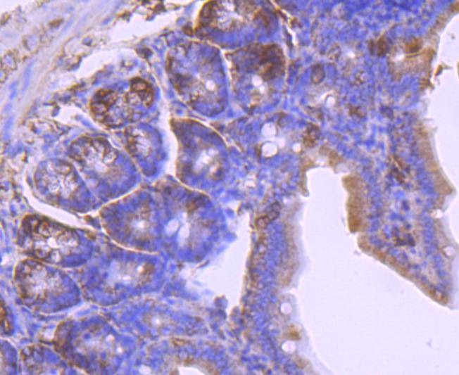 Anti-LAMB1 Antibody (6K439)