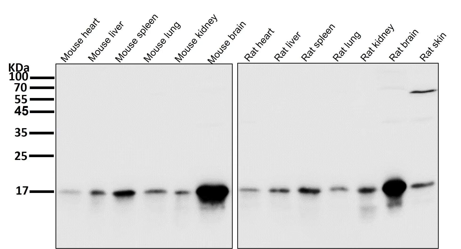 Anti-MAP1LC3B Antibody (7N270)