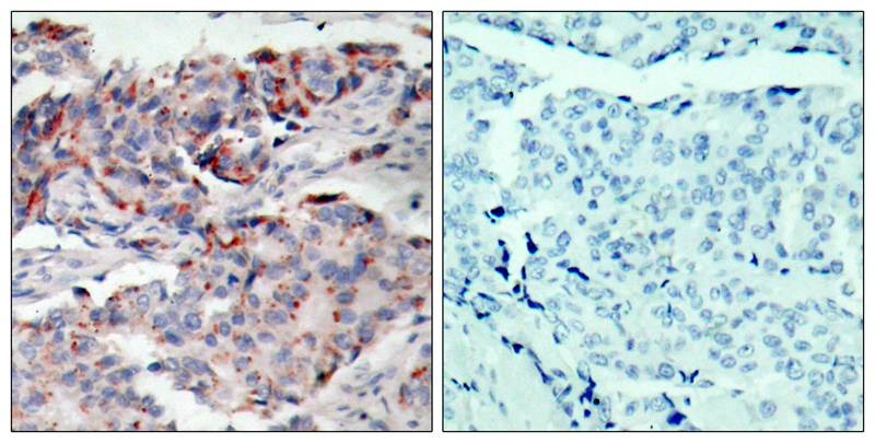Anti-Phospho-JAK2 (Tyr221) Polyclonal Antibody 2