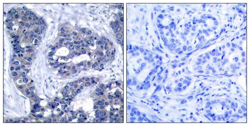 Anti-Phospho-IRS-1 (Ser639) Polyclonal Antibody