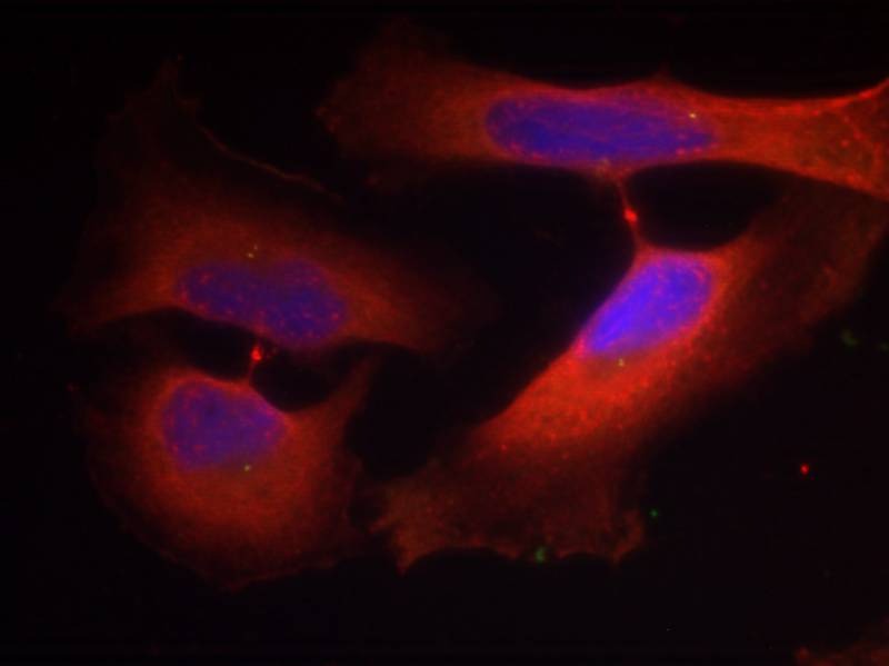 Anti-Phospho-KRT8 (Ser74) Polyclonal Antibody