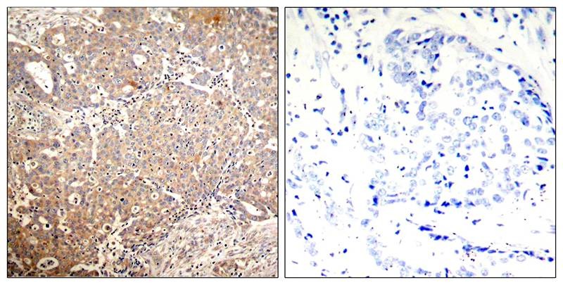 Anti-Phospho-KRT18 (Ser33) Polyclonal Antibody