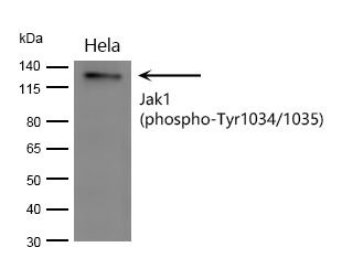 Anti-Phospho-JAK1 (Tyr1034, 1035) Polyclonal Antibody 2