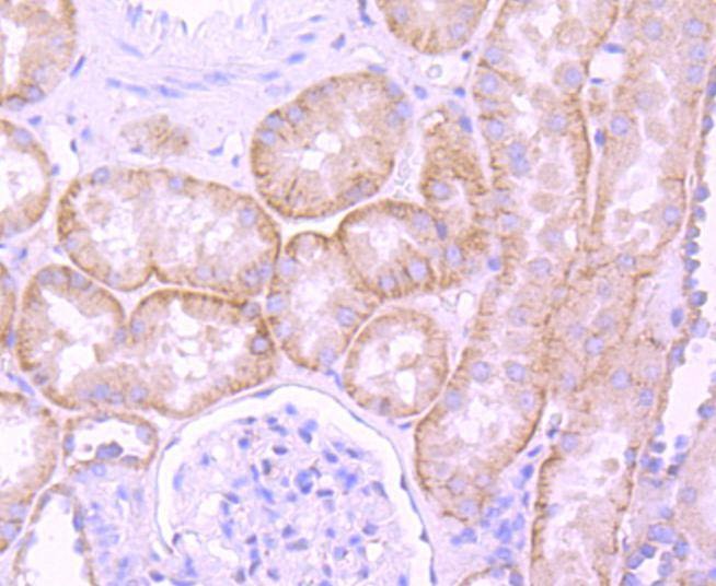 Anti-LAMB1 Antibody (6K439)