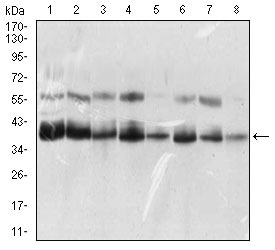 Anti-KHDRBS2 Antibody (3H737)